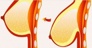 8 hoitoa rintojen kiinteyttämiseksi