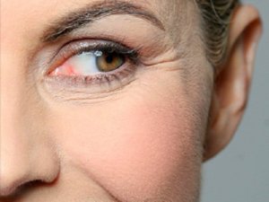 omenaviinietikka torjuu ryppyjä