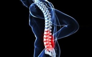 5 harvinaista syöpää