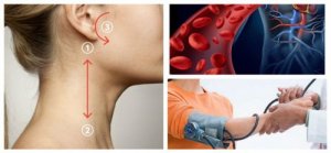 Alenna verenpainetta luonnollisesti 5 minuutissa