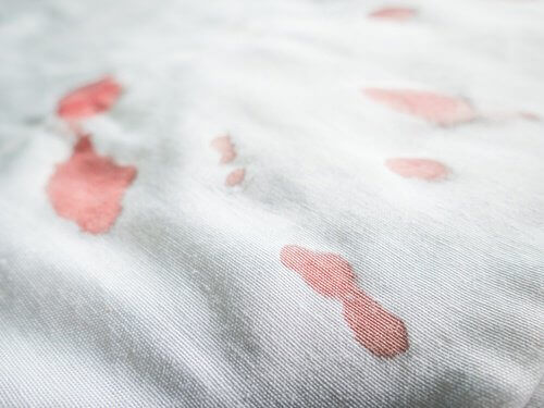 Aspiriinista on apua myös veritahrojen poistossa.