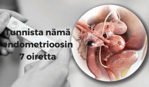 7 merkkiä endometrioosista