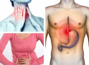 Kärsitkö närästyksestä?