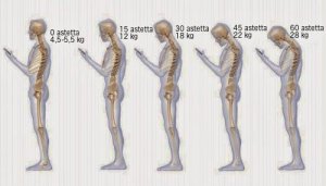 6 huonoa tapaa, jotka aiheuttaa niskakipuja