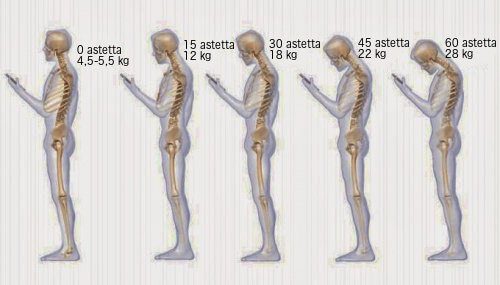 Huono ryhti aiheuttaa niskakipuja.