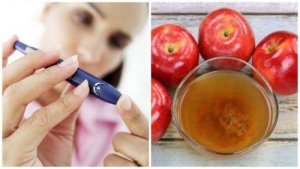 Omenaviinietikka auttaa kontrolloimaan diabetesta
