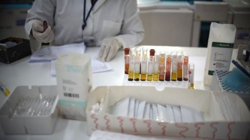 Krimin-Kongon verenvuotokuume laboratoriossa