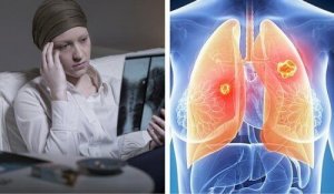 Keuhkosyöpä tappaa enemmän naisia