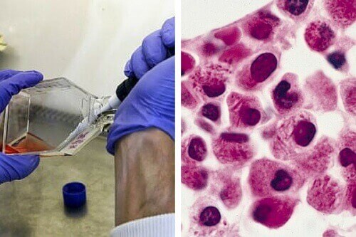 Uusi läpimurto: leukemiasolut voivat tuhota itse itsensä