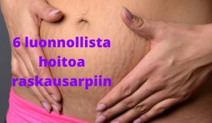 6 loistavaa keinoa raskausarpien häivyttämiseen