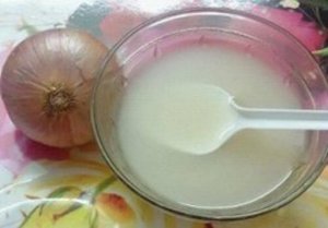 Sipuli ja etikka avuksi jalkojen kovettumiin