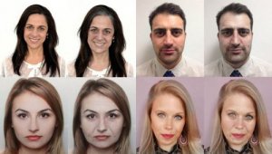 10 stressin haitallista vaikutusta ulkonäköösi