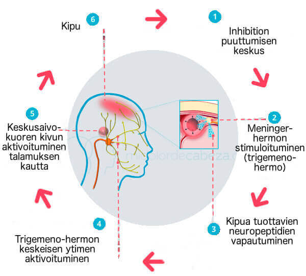 keskushermosto - naisten sairaudet
