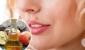 Luomien poistaminen luonnollisesti