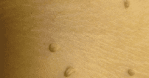 vicks vaporub hoitaa syylät