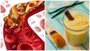 5 parasta ruoka-ainetta tukkeutuneiden valtimoiden puhdistamiseen