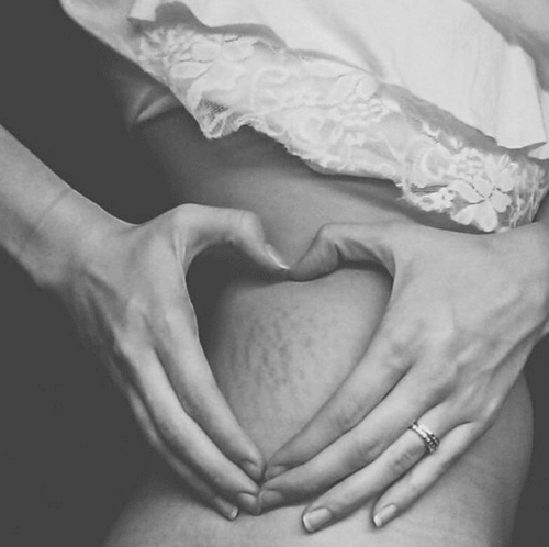 hyväksy vartalosi arpineen