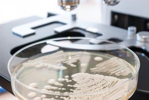 10 hiivasienen kasvua estävää ruokaa