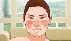 7 hoitokeinoa punahukan hallintaan