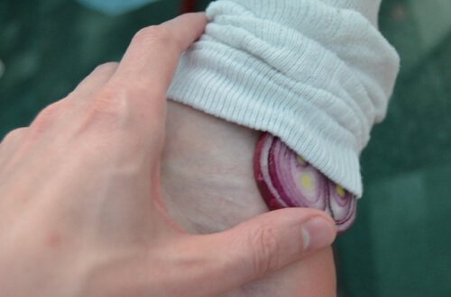 jalat ja sipulihoito