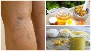 Hoida suonikohjuja arnikilla