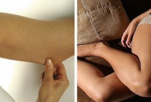 Kiinteytä käsivarret ja reidet helposti