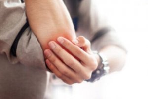 Bursiitin hoito - 5 luonnollista tapaa