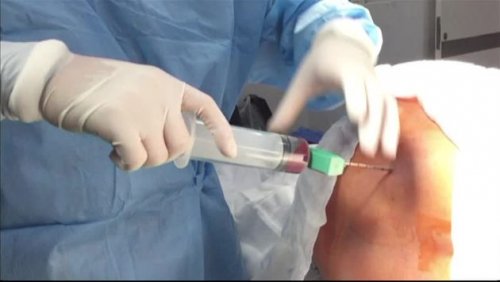 luuydinsiirto voi pelastaa ihmiselämän