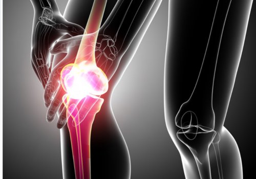 lonkkakivun aiheuttajat: jännetulehdus