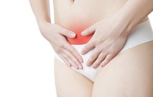 5 asiaa, jotka on hyvä tietää endometrioosista