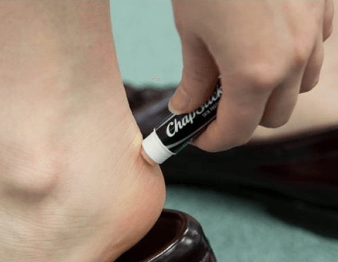 huulirasva jalkarakolle