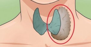 Kilpirauhasongelmien 14 merkkiä ja oiretta