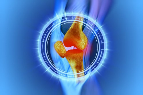 nivelkierukan repeäminen