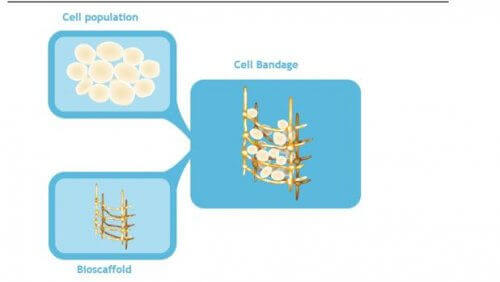 Kantasolusideharso nivelkierukan hoidossa