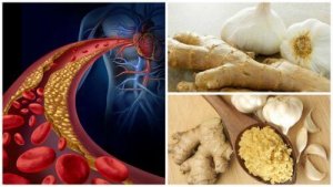 Torju korkeaa verenpainetta ja kolesterolia inkiväärillä ja valkosipulilla