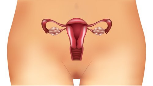 Munasarjojen monirakkulaoireyhtymän (PCOS) huonosti tunnetut oireet