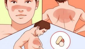 Mitä punahukasta tulisi tietää?