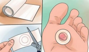 9 hoitokeinoa parantamaan jalkojen rakot