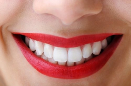 aktiivihiilen käyttötapa hampaiden valkaisu