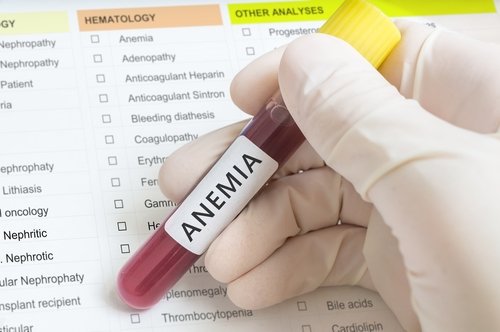 verinäyte anemia