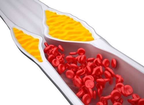 4 smoothieta kontrolloimaan kolesterolia 4 smoothieta kontrolloimaan kolesterolia