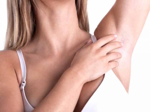 möykyt kainaloissa ovat varoitusmerkkejä