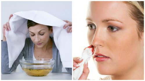 7 tehokasta kotihoitoa nenän verenvuotoon 7 tehokasta kotihoitoa nenän verenvuotoon