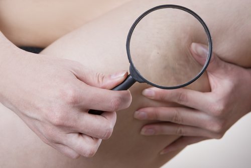 tutkaillaan selluliittia suurennuslasilla