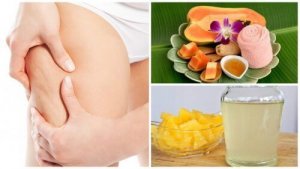 Näin poistat näkyvää selluliittia - 5 hoitoa