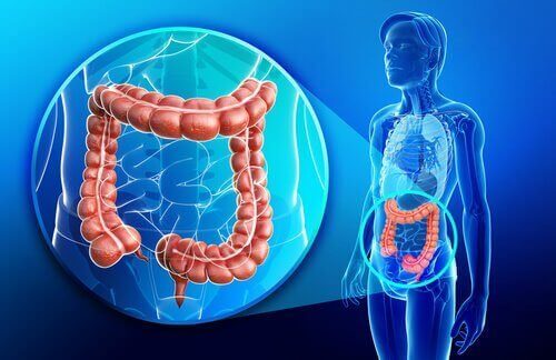 Mikä on Crohnin tauti?