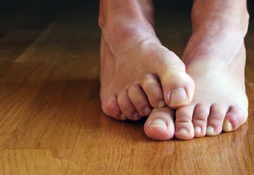 6 luontaishoitoa jalkasieneen