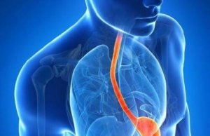 10 outoa refluksitaudin oiretta