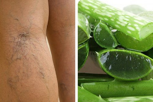 verenkierron parantaminen aloe veralla