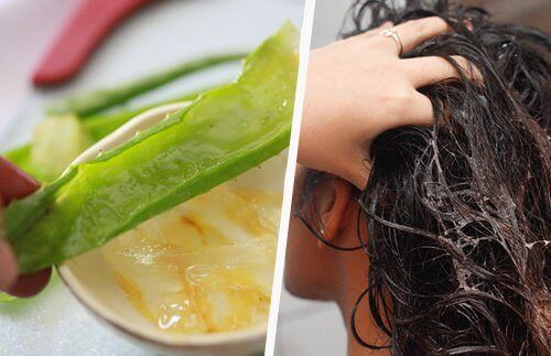 Aloe verasta voi olla apua hiustenlähtöön.